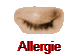 Allergie